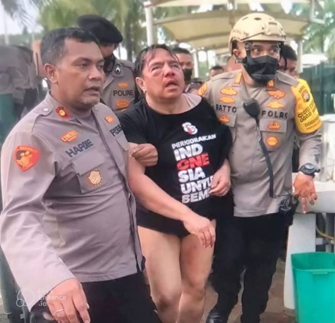 
					𝗕𝗼𝗻𝗴𝗸𝗮𝗿 𝗞𝗲𝗹𝗶𝗰𝗶𝗸𝗮𝗻 𝗔𝗱𝗲 𝗔𝗿𝗺𝗮𝗻𝗱𝗼, 𝗣𝗼𝘁𝗼𝗻𝗴 𝗖𝗲𝗿𝗮𝗺𝗮𝗵 𝗝𝗞 𝗗𝗲𝗺𝗶 𝗔𝗱𝘀𝗲𝗻𝘀𝗲 𝗱𝗮𝗻 𝗕𝗮𝗹𝗮𝘀 𝗗𝗲𝗻𝗱𝗮𝗺 𝗣𝗼𝗹𝗶𝘁𝗶𝗸.